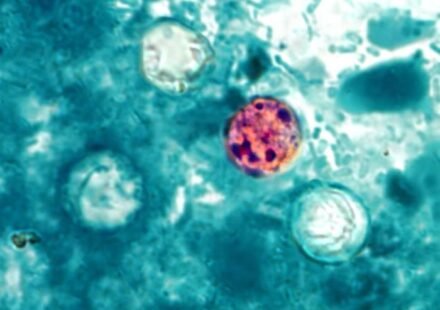Cyclospora_cayetanensis.