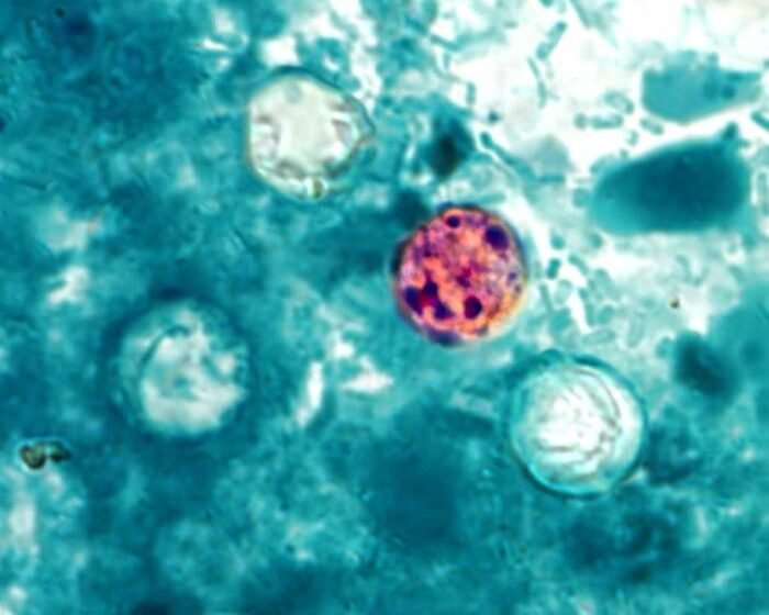Cyclospora Outbreak Spreads Across US, Produce Implicated image - Cyclospora_cayetanensis.